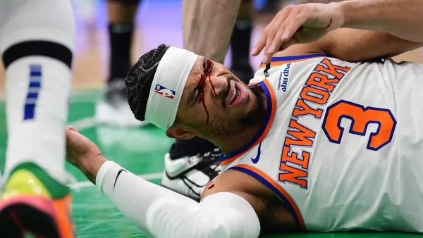 Knicks' Josh Hart Sustains Bloody Eye Cut During Loss to Celtics